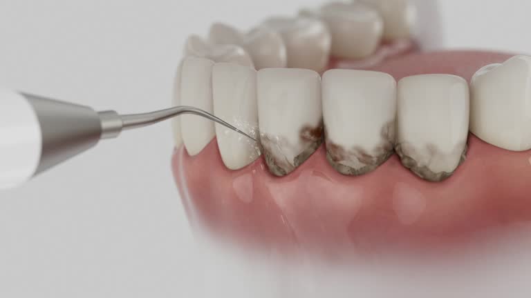 Trusted Root Canal Treatment service in Toledo, IA - Dentist Open Now